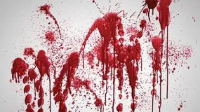 Bloody Massacre